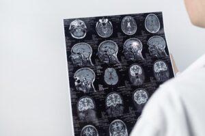 How Many Types of Brain Injuries are There?​